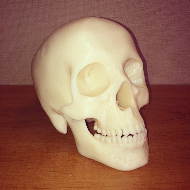 越聯3D打印頭骨